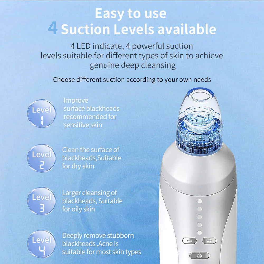 Blackhead & Acne Suction Tool — Deep Clean Magic