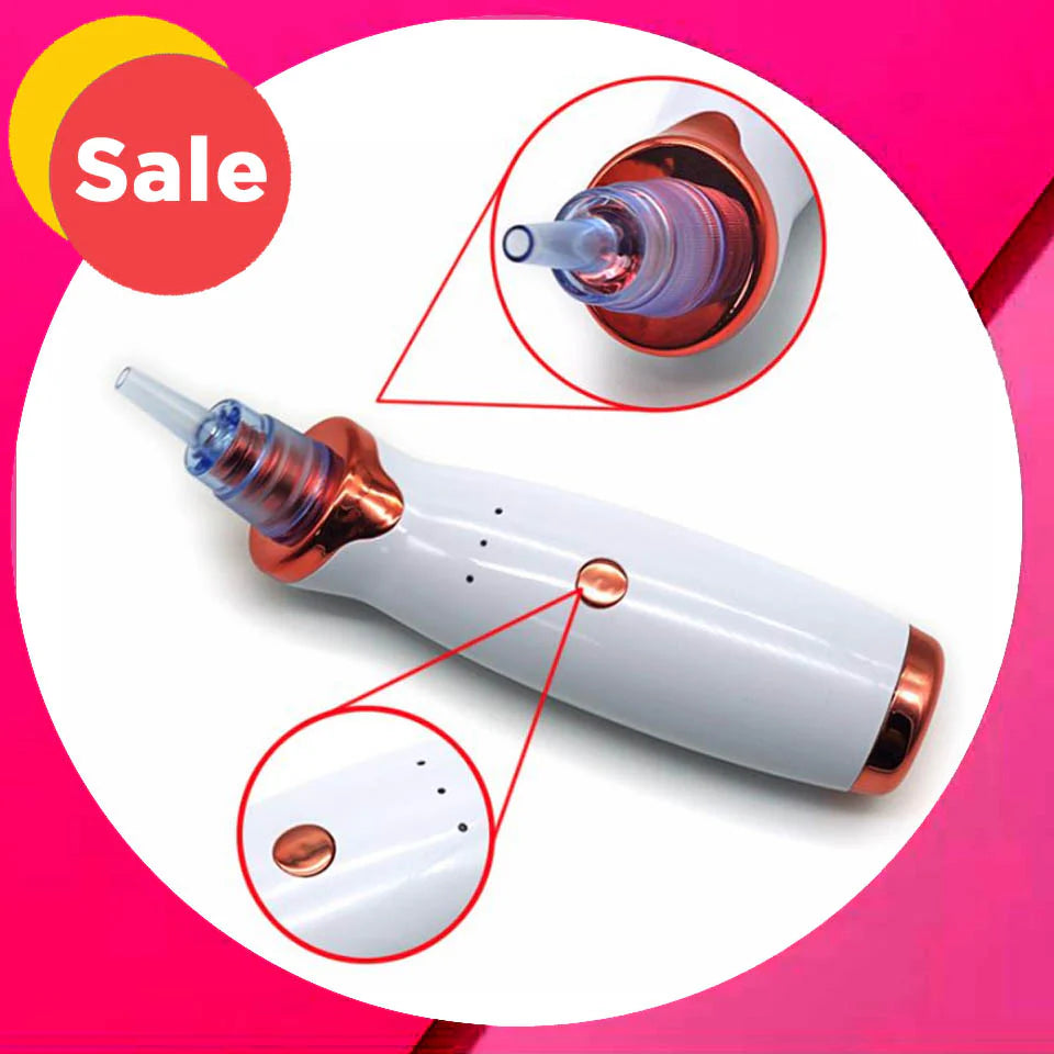 BESTOPE Blackhead Removal Tool — Gentle & Precise