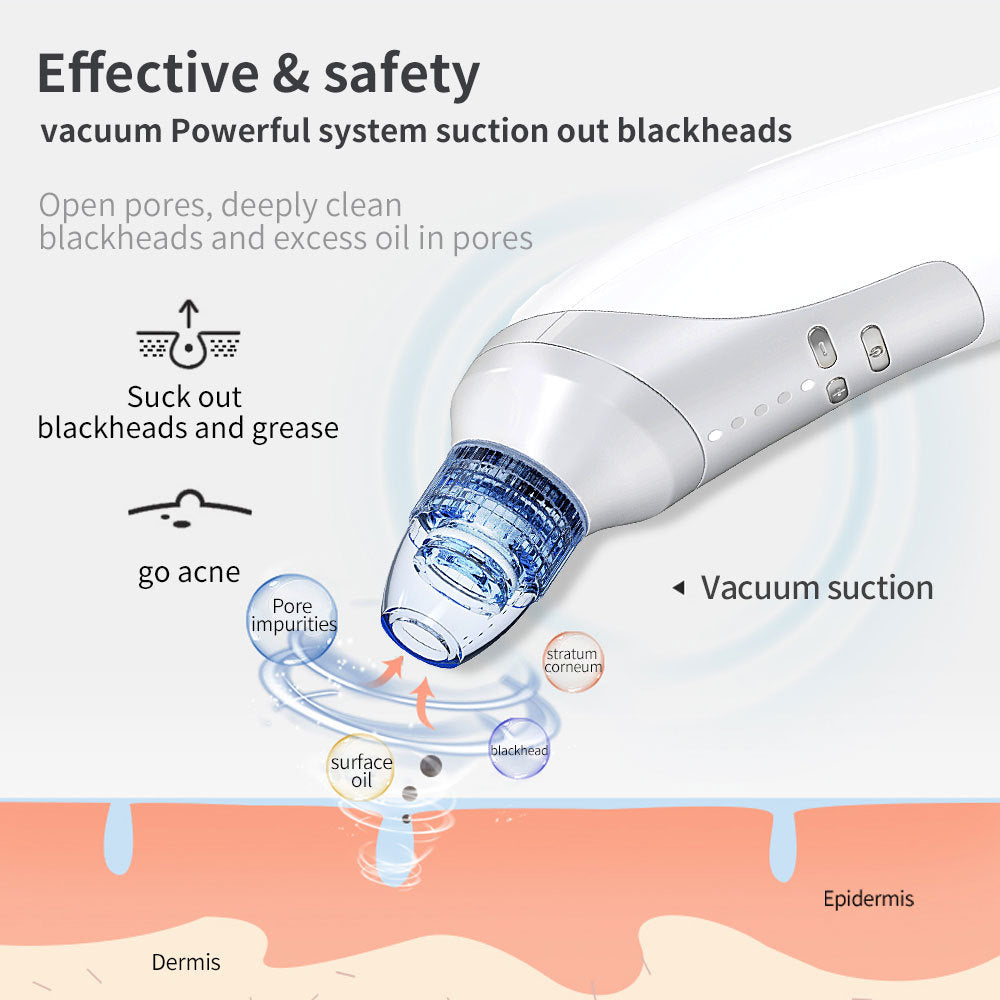 Blackhead & Acne Suction Tool — Deep Clean Magic