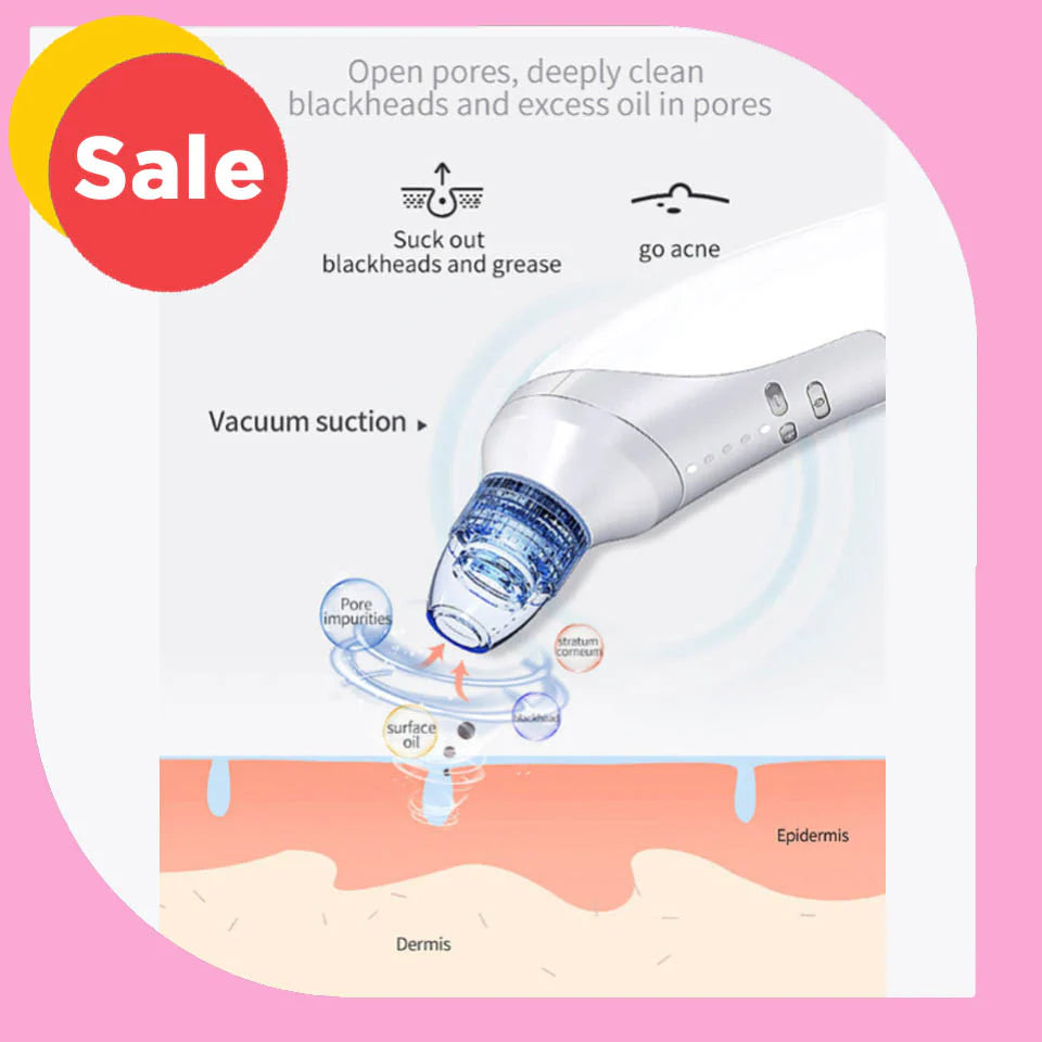 Blackhead & Acne Suction Tool — Deep Clean Magic