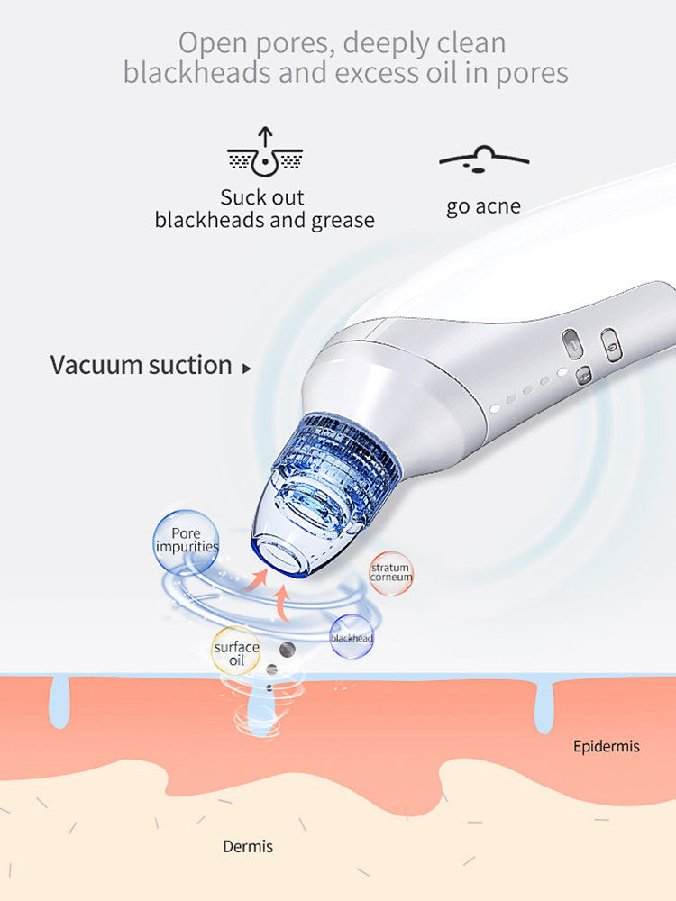 Blackhead & Acne Suction Tool — Deep Clean Magic